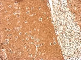 Anti-Presenilin 1 antibody [C1C2], Internal used in IHC (Paraffin sections) (IHC-P). GTX116016