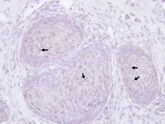 Anti-Presenilin 1 antibody [C1C2], Internal used in IHC (Paraffin sections) (IHC-P). GTX116016
