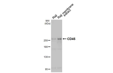 Anti-CD45 antibody used in Western Blot (WB). GTX116018