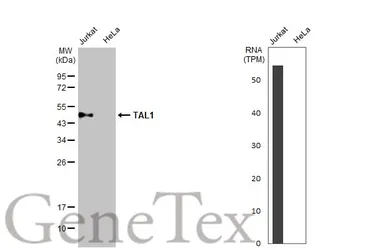 Anti-TAL1 antibody [C2C3], C-term used in Western Blot (WB). GTX116020