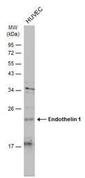Anti-Endothelin 1 antibody [C1C3] used in Western Blot (WB). GTX116033