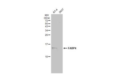 Anti-FABP4 antibody [N3C3] used in Western Blot (WB). GTX116036