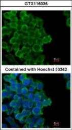 Anti-FABP4 antibody [N3C3] used in Immunocytochemistry/ Immunofluorescence (ICC/IF). GTX116036