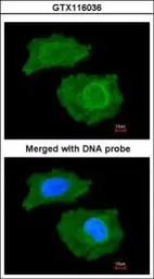 Anti-FABP4 antibody [N3C3] used in Immunocytochemistry/ Immunofluorescence (ICC/IF). GTX116036