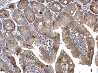 Anti-H-Ras antibody used in IHC (Paraffin sections) (IHC-P). GTX116041