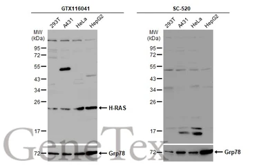 Anti-H-Ras antibody used in Western Blot (WB). GTX116041