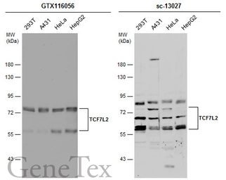 Anti-TCF7L2 antibody used in Western Blot (WB). GTX116056