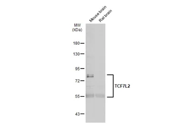 Anti-TCF7L2 antibody used in Western Blot (WB). GTX116056