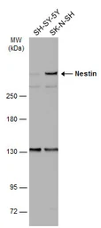 Anti-Nestin antibody used in Western Blot (WB). GTX116066