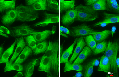 Anti-Nestin antibody used in Immunocytochemistry/ Immunofluorescence (ICC/IF). GTX116066