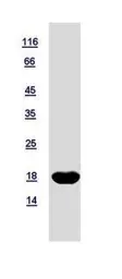 Human nm23-H2 protein, His tag. GTX116091-pro