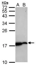 Anti-nm23-H2 antibody used in Western Blot (WB). GTX116091