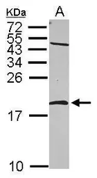Anti-nm23-H2 antibody used in Western Blot (WB). GTX116091