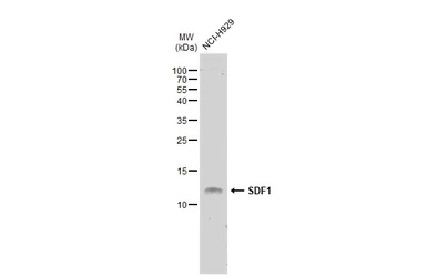 Anti-SDF1 antibody [N1C3] used in Western Blot (WB). GTX116092