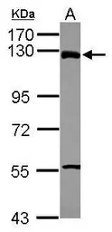 Anti-ZNF295 antibody [N1N2], N-term used in Western Blot (WB). GTX116110
