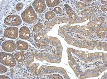 Anti-HEBP1 antibody [N1C3] used in IHC (Paraffin sections) (IHC-P). GTX116121