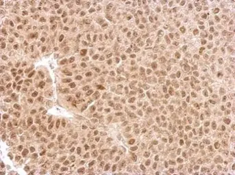 Anti-EXOSC3 antibody used in IHC (Paraffin sections) (IHC-P). GTX116123