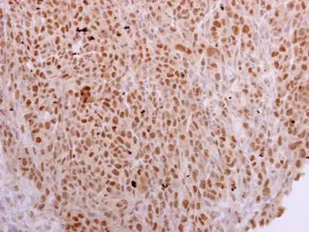 Anti-NOSIP antibody [N1C3] used in IHC (Paraffin sections) (IHC-P). GTX116126