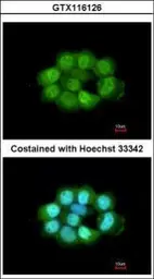 Anti-NOSIP antibody [N1C3] used in Immunocytochemistry/ Immunofluorescence (ICC/IF). GTX116126