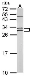 Anti-NOSIP antibody [N1C3] used in Western Blot (WB). GTX116126