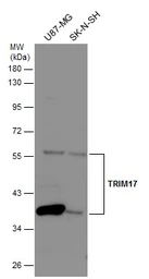 Anti-TRIM17 antibody [N1N3] used in Western Blot (WB). GTX116138