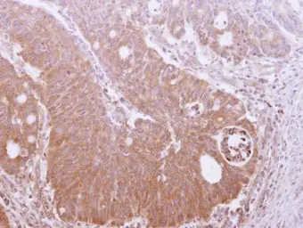 Anti-TRIM17 antibody [N1N3] used in IHC (Paraffin sections) (IHC-P). GTX116138