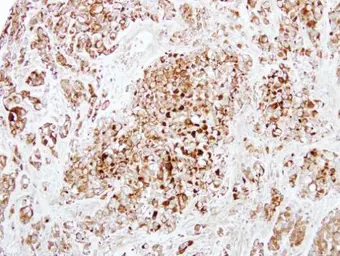 Anti-DCXR antibody [N1C3] used in IHC (Paraffin sections) (IHC-P). GTX116147
