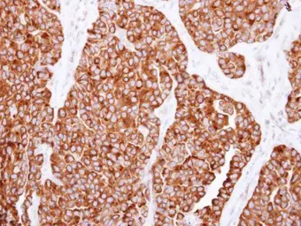 Anti-SNX7 antibody used in IHC (Paraffin sections) (IHC-P). GTX116160