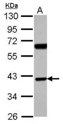 Anti-SNX7 antibody used in Western Blot (WB). GTX116160