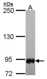 Anti-SFMBT1 antibody [N1N2], N-term used in Western Blot (WB). GTX116167