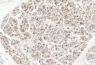 Anti-TNFAIP1 antibody used in IHC (Paraffin sections) (IHC-P). GTX11617