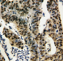 Anti-TNFAIP1 antibody used in IHC (Paraffin sections) (IHC-P). GTX11617