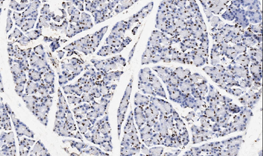 Anti-TNFAIP1 antibody used in IHC (Paraffin sections) (IHC-P). GTX11617