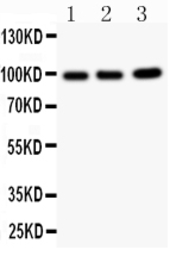 Anti-TNFAIP1 antibody used in Western Blot (WB). GTX11617