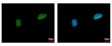 Anti-PIASy antibody used in Immunocytochemistry/ Immunofluorescence (ICC/IF). GTX116181