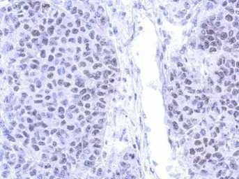 Anti-PIASy antibody used in IHC (Paraffin sections) (IHC-P). GTX116181