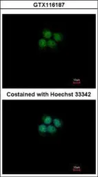Anti-CPSF73 antibody used in Immunocytochemistry/ Immunofluorescence (ICC/IF). GTX116187