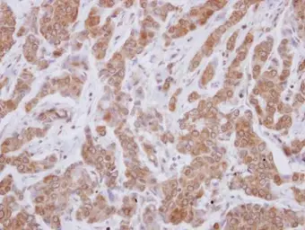 Anti-VPS29 antibody used in IHC (Paraffin sections) (IHC-P). GTX116189