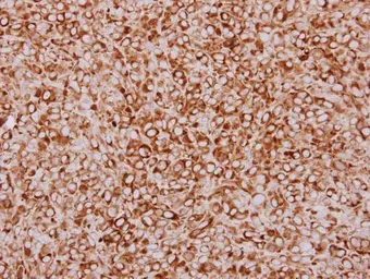 Anti-ZFYVE1 antibody [C1C3] used in IHC (Paraffin sections) (IHC-P). GTX116203