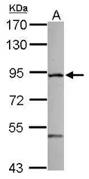 Anti-ZFYVE1 antibody [C1C3] used in Western Blot (WB). GTX116203