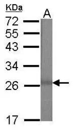 Anti-MBD3 antibody [N1C3] used in Western Blot (WB). GTX116204