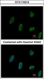 Anti-ZNF207 antibody [N3C3] used in Immunocytochemistry/ Immunofluorescence (ICC/IF). GTX116214