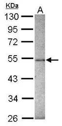 Anti-ZNF213 antibody [N1C1] used in Western Blot (WB). GTX116215