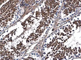 Anti-DNALI1 antibody used in IHC (Paraffin sections) (IHC-P). GTX116217