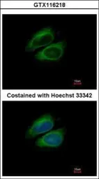 Anti-CSDE1 antibody [N2C1], Internal used in Immunocytochemistry/ Immunofluorescence (ICC/IF). GTX116218