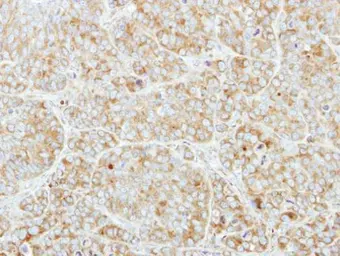 Anti-CSDE1 antibody [N2C1], Internal used in IHC (Paraffin sections) (IHC-P). GTX116218