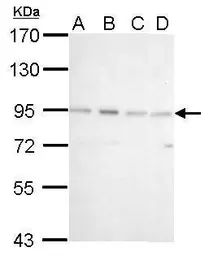 Anti-CSDE1 antibody [N2C1], Internal used in Western Blot (WB). GTX116218