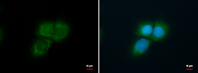 Anti-KF1 antibody used in Immunocytochemistry/ Immunofluorescence (ICC/IF). GTX116221