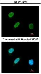 Anti-BRF2 antibody [N1C1] used in Immunocytochemistry/ Immunofluorescence (ICC/IF). GTX116223