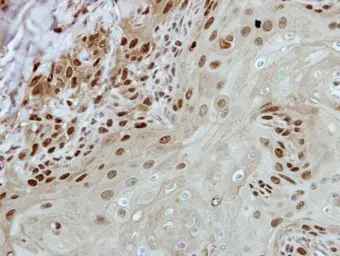 Anti-BRF2 antibody [N1C1] used in IHC (Paraffin sections) (IHC-P). GTX116223